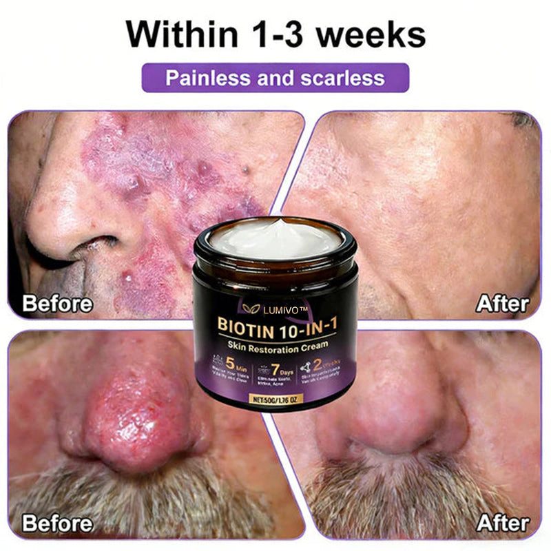 Ends Today: 80% OFF!✨LUMIVO® Biotin 10-in-1 Skin Restoration Cream 🍀Made and Shipped from USA
