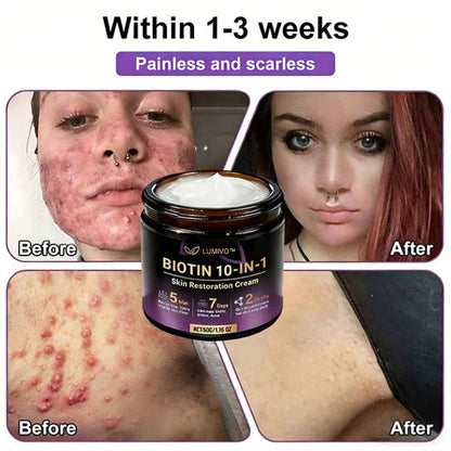 Ends Today: 80% OFF!✨LUMIVO® Biotin 10-in-1 Skin Restoration Cream 🍀Made and Shipped from USA